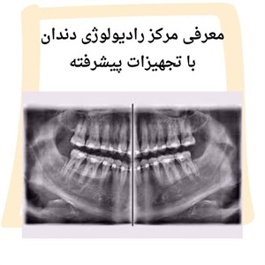 مزایای مراجعه به رادیولوژی دندان سعادت آباد